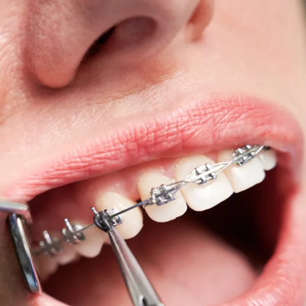 FUNDAMENTAL Remscheid bietet Fortbildungen in Zahnmedizin, Zahntechnik, Curricula & für dentales Fachpersonal – lebendig, praxisnah & persönlich.